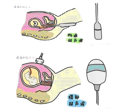 無(wú)標(biāo)題_編輯.jpg